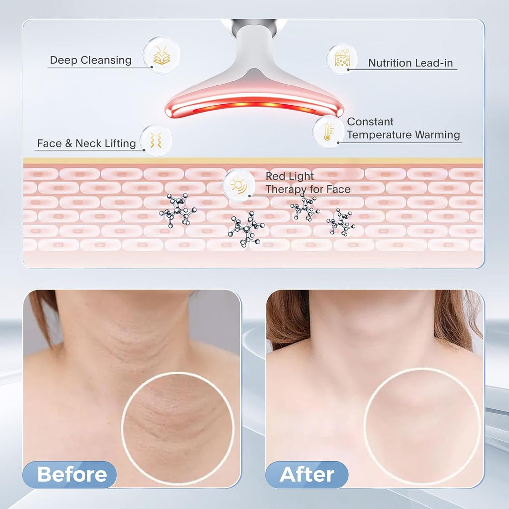 جهاز تقليل التجاعيد بالضوء النبضي المكثف مع سيروم الذهب 24 وجل الألوفيرا - Skinova Intense Pulsed Light Wrinkle Reducing Device with 24K Gold Serum & Aloe Vera Gel